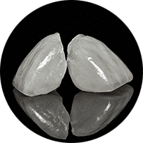 審美セラミック治療